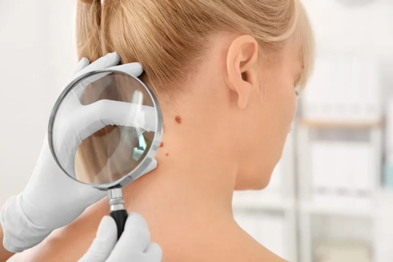 What You Need to Know About Skin Cancer
